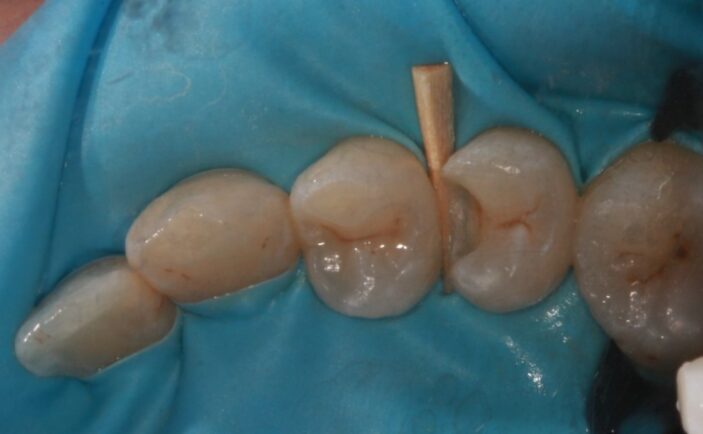 Before - Brunswick Dental Practice