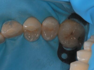 After - Brunswick Dental Practice