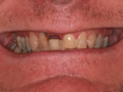 After - Brunswick Dental Practice