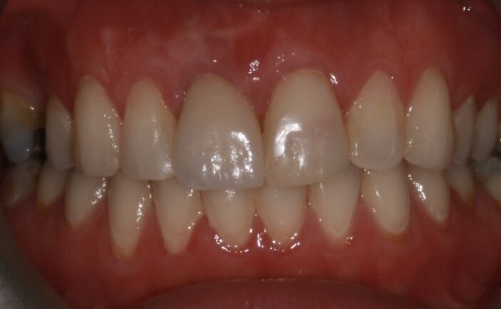 After - Brunswick Dental Practice