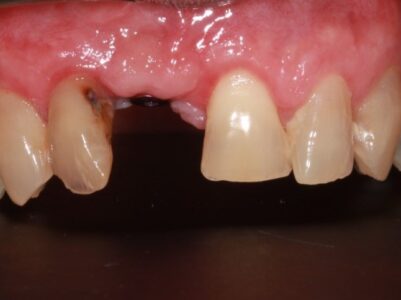 Before -Brunswick Dental Practice