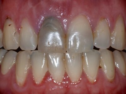 Before -Brunswick Dental Practice