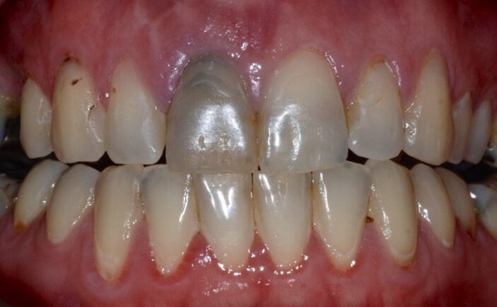 Before - Brunswick Dental Practice