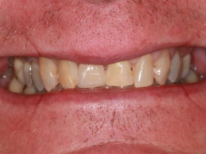 After - Brunswick Dental Practice