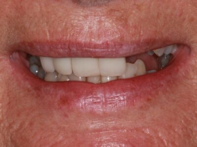 Before -Brunswick Dental Practice