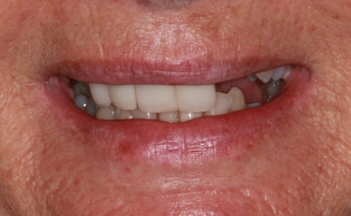 Before - Brunswick Dental Practice