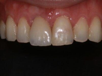 After - Brunswick Dental Practice