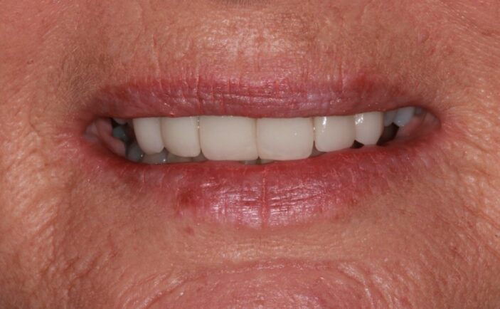 After - Brunswick Dental Practice