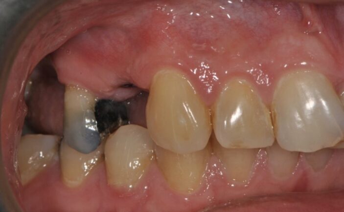 Before - Brunswick Dental Practice