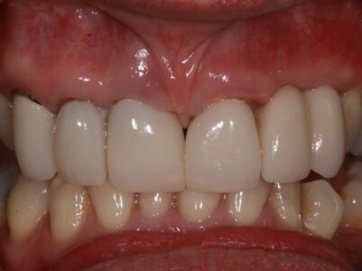 After - Brunswick Dental Practice