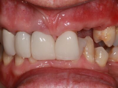 After - Brunswick Dental Practice