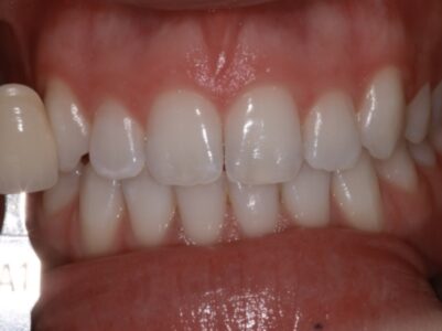 After - Brunswick Dental Practice