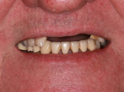 Before -Brunswick Dental Practice