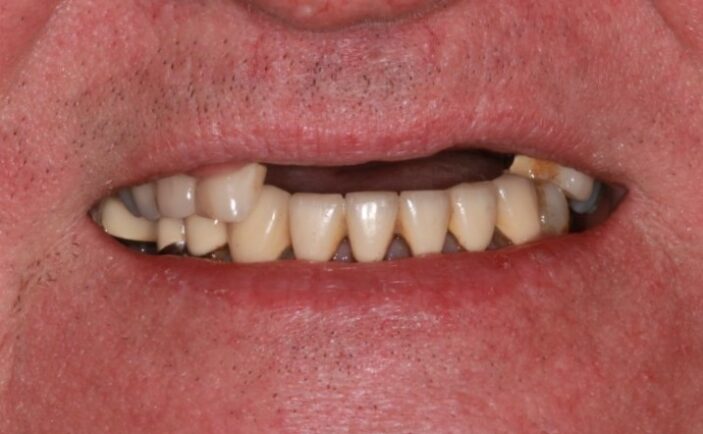 Before - Brunswick Dental Practice