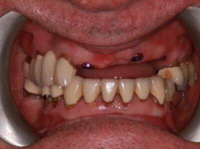 After - Brunswick Dental Practice