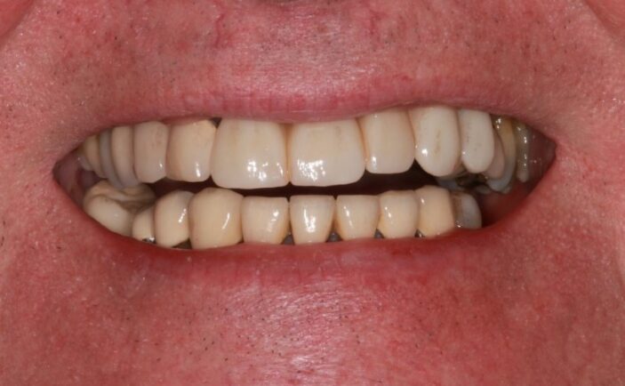 After - Brunswick Dental Practice