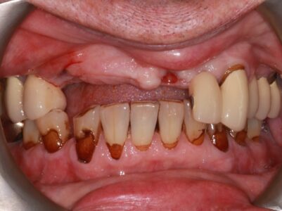 Before -Brunswick Dental Practice