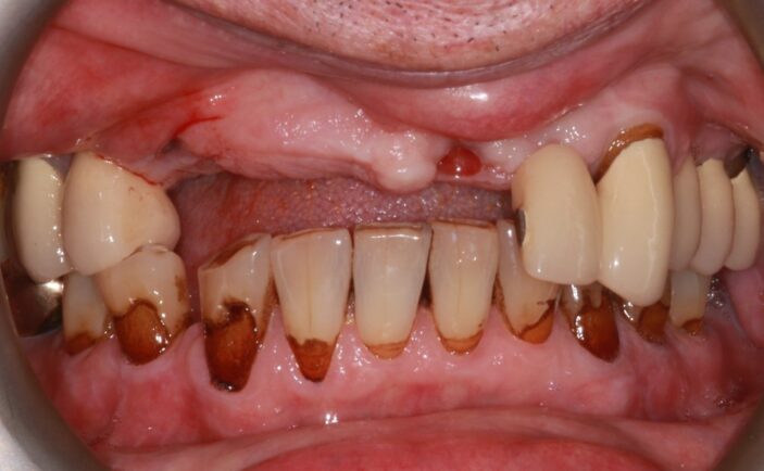 Before - Brunswick Dental Practice