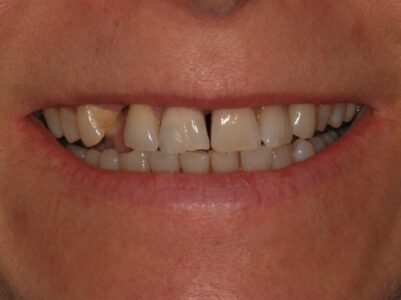 Before -Brunswick Dental Practice