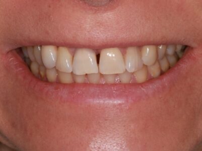 After - Brunswick Dental Practice