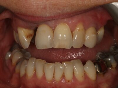 Before -Brunswick Dental Practice