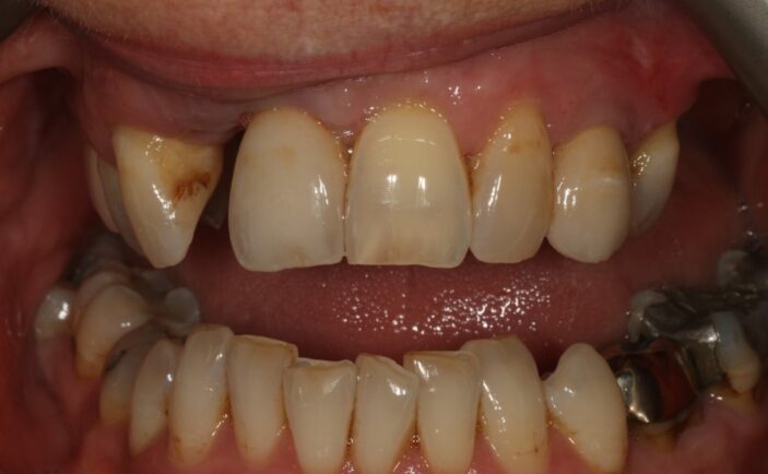 Before - Brunswick Dental Practice