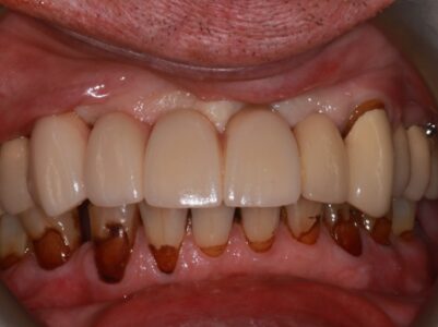 After - Brunswick Dental Practice