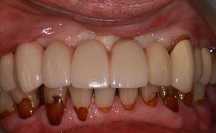 After - Brunswick Dental Practice