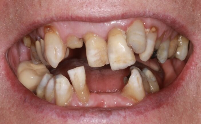 Before - Brunswick Dental Practice