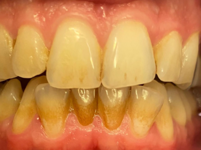 Before - Brunswick Dental Practice