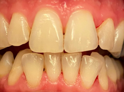 After - Brunswick Dental Practice