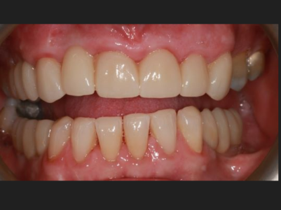 After - Brunswick Dental Practice