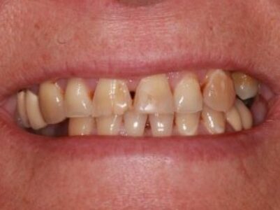 After - Brunswick Dental Practice