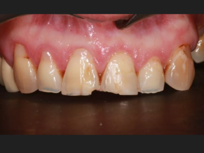 Before -Brunswick Dental Practice