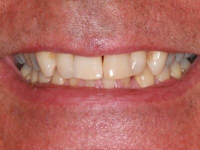 After - Brunswick Dental Practice