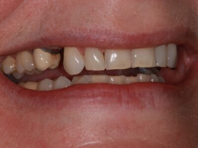 Before -Brunswick Dental Practice