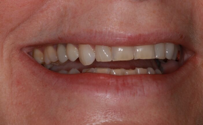 After - Brunswick Dental Practice