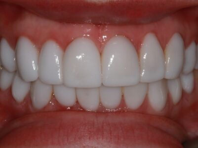 After - Brunswick Dental Practice