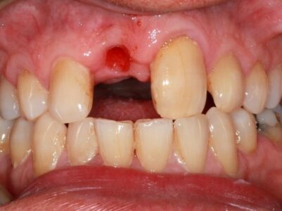 Before -Brunswick Dental Practice