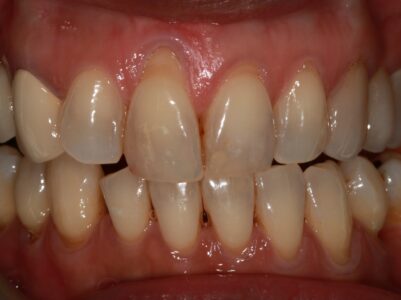 Before - Brunswick Dental Practice