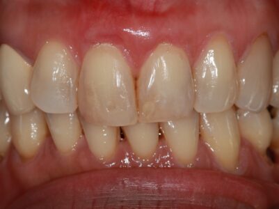 After - Brunswick Dental Practice