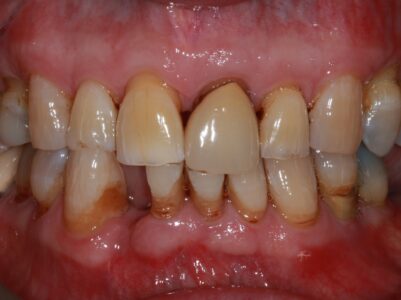 Before - Brunswick Dental Practice