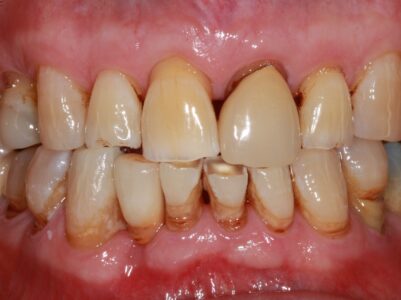 After - Brunswick Dental Practice