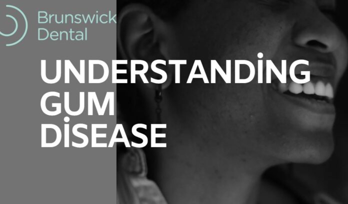 blog - Brunswick Dental