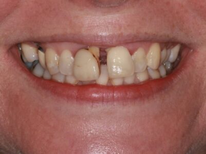 Before - Brunswick Dental Practice