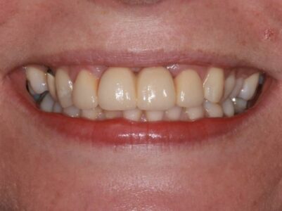 After - Brunswick Dental Practice