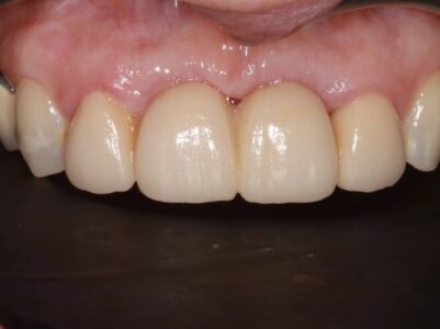 After - Brunswick Dental Practice