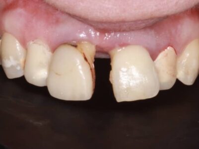 Before Face - Brunswick Dental Practice