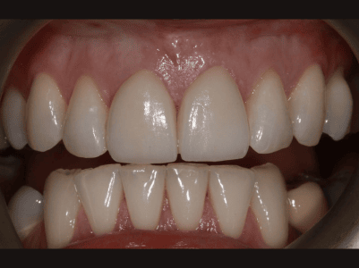 After - Brunswick Dental Practice