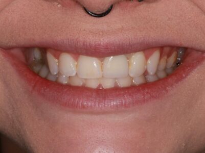 After - Brunswick Dental Practice